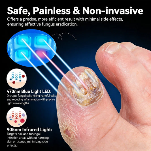 Repair Nail Fungus Laser Treatment